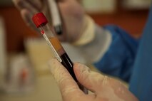 Senior Airman Luis Poblano, 5th Medical Support Squadron laboratory technician, examines a blood sample at Minot Air Force Base, N.D., July 8, 2015. Examinations like these are important to the Minot mission because they make sure Airmen are fit to fight. (U.S. Air Force photo/Airman 1st Class Christian Sullivan)