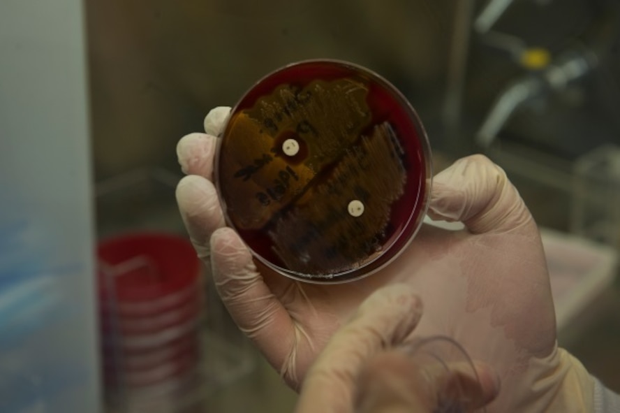 Senior Airman Luis Poblano, 5th Medical Support Squadron laboratory technician, examines a strep throat sample at Minot Air Force Base, N.D., July 8, 2015. Lab personnel keep examples like these on hand for reference and training. (U.S. Air Force photo/Airman 1st Class Christian Sullivan)