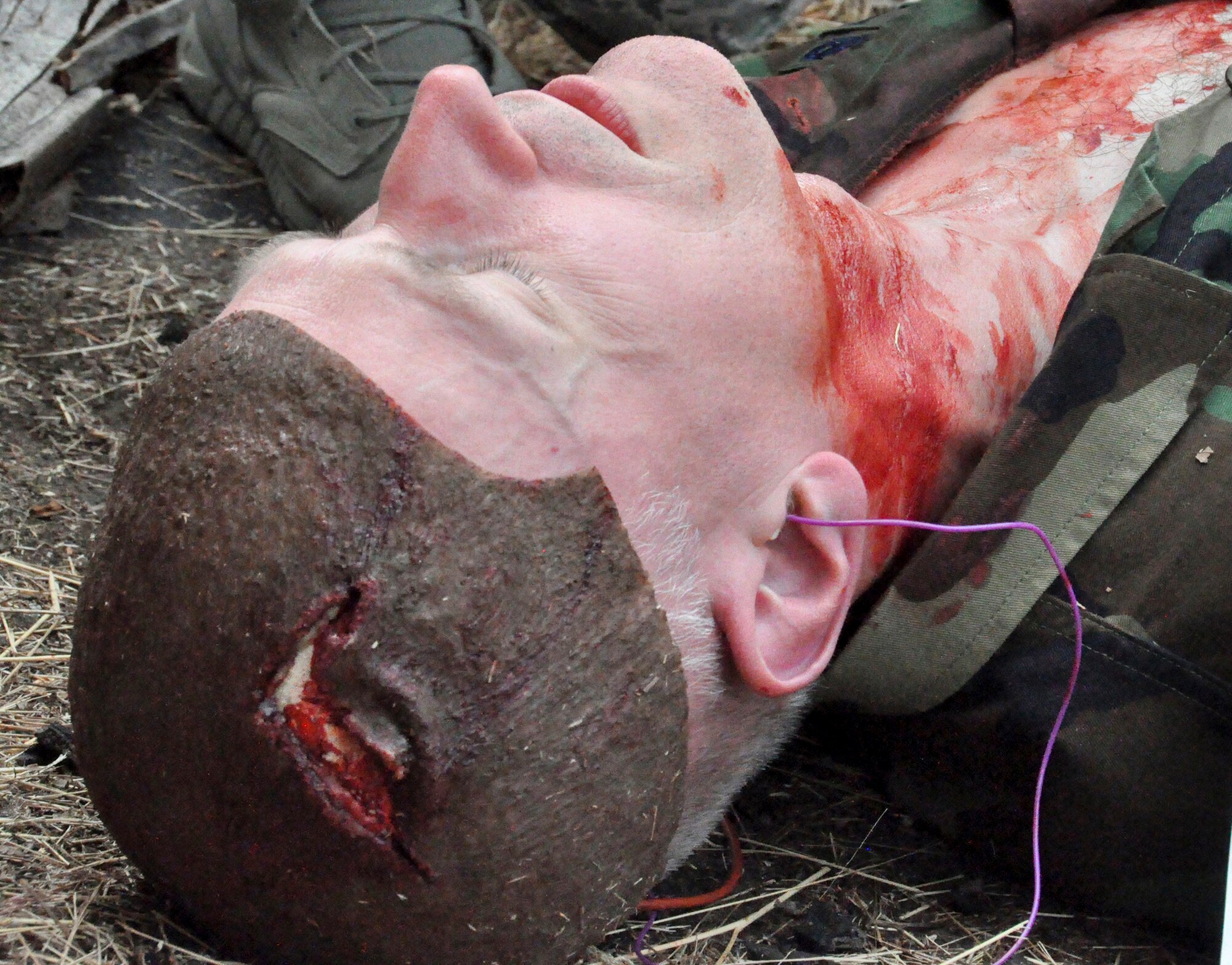 Senior Master Sgt. Jonathan Lapham, 446th Aeromedical Staging Squadron medical technician, acts as a casualty with a scalp laceration attack as part of tactical combat casualty care training July 13 at the South 40, South Approach, here. Training for TCCC was a unique addition this year and part of a four-day field training mass casualty exercise, dubbed “Care Under Fire.”