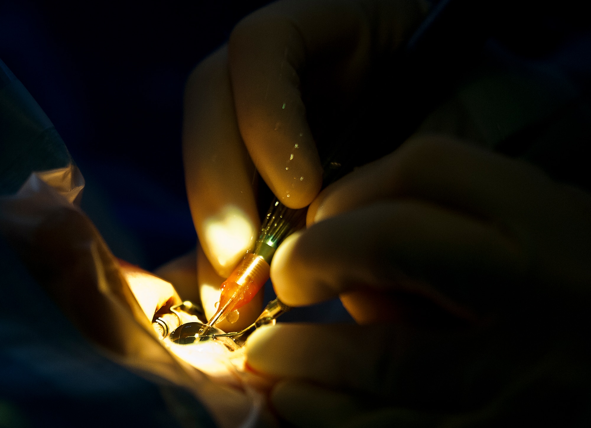 Maj. Sarah Eccles-Brown, 96th Surgical Operations Squadron, sprays a balanced salt solution with an ultrasound handpiece to maintain the shape of the eye during cataract surgery performed at Eglin Air Force Base, Fla.  During the procedure, the surgeon removes the eye’s cloudy lens known as a cataract and replaces it with a new clear lens implant.  The surgery takes approximately 20 minutes.  The 96th Medical Group performs approximately 150 cataract surgeries per year.  (U.S. Air Force photo/Samuel King Jr.)