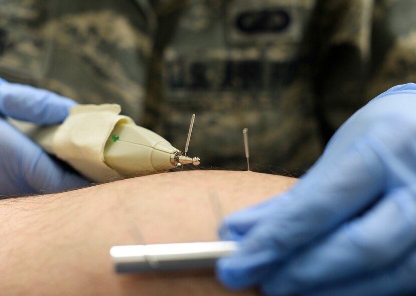 Lt. Col. Linda Currier, 374th Surgical Operations Squadron surgical services flight commander, sends an electric current into her patient’s calf muscle via acupuncture needles at Yokota Air Base, Japan, Jun 30, 2015. Low doses of electrical currents help to quickly alleviate tightness and pain in muscles, allowing the area to return to normal movement. (U.S. Air Force photo by Airman 1st Class Elizabeth Baker/Released)