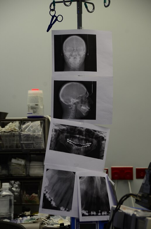 Oral Surgeons Another side of dentistry > Royal Air Force Lakenheath