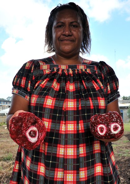 Malavi Masuve, the secretary for the director of corporate relations at Goroka Hospital in Goroka, Papua New Guinea, displays her simulated "double amputee" wounds before a mass casualty response exercise for Pacific Angel 15-4, June 5, 2015. The hospital worked for a week with U.S. military doctors, nurses and medics to develop its first disaster response plan -- essentially, a plan for situations when standard patient treatment and transport systems would be highly stressed. The hospital staff chose a simulated bus rollover as their final test. Efforts undertaken during Pacific Angel help multilateral militaries in the Pacific improve and build relationships across a wide spectrum of civic operations, which bolsters each nation???s capacity to respond and support future humanitarian assistance and disaster relief operations. (U.S. Air Force photo by 1st Lt. Michael Trent Harrington/Released)