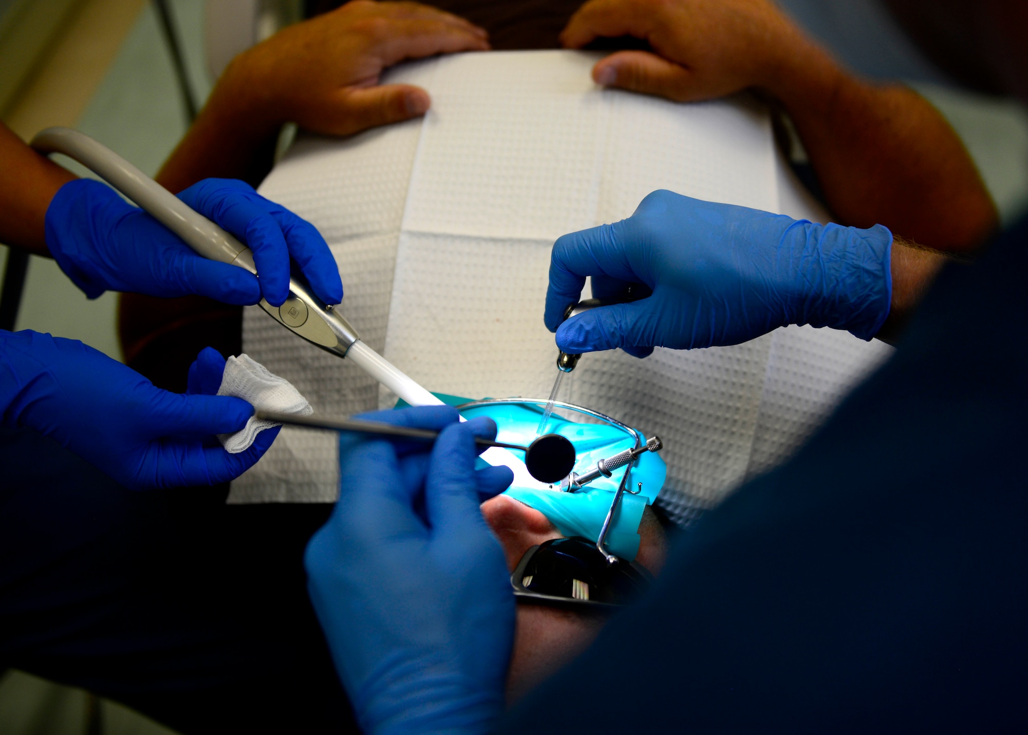 Dustin Drake, 31st Force Support Squadron golf course superintendent, receives a filling, June 23, 2015, at Aviano Air Base, Italy. Dental Airmen provide periodontics, orthodontic, prosthesis and pediatric dental services to all Team Aviano members. (U.S. Air Force photo by Senior Airman Areca T. Wilson/Released)