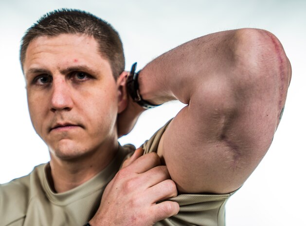 First Lt. Kevin Summerbell, 15th Airlift Squadron C-17 Globemaster III pilot, shows where the bullet exited his arm after being shot in Iraq by enemy combatants while serving in the United States Army Feb. 19, 2015, at Joint Base Charleston, S.C. Summerbell later attended Officer Training School and commissioned as an officer in the Air Force to be a C-17 pilot, the same aircraft he was flown back on after being wounded in combat. (U.S. Air Force photo/ Senior Airman Dennis Sloan)