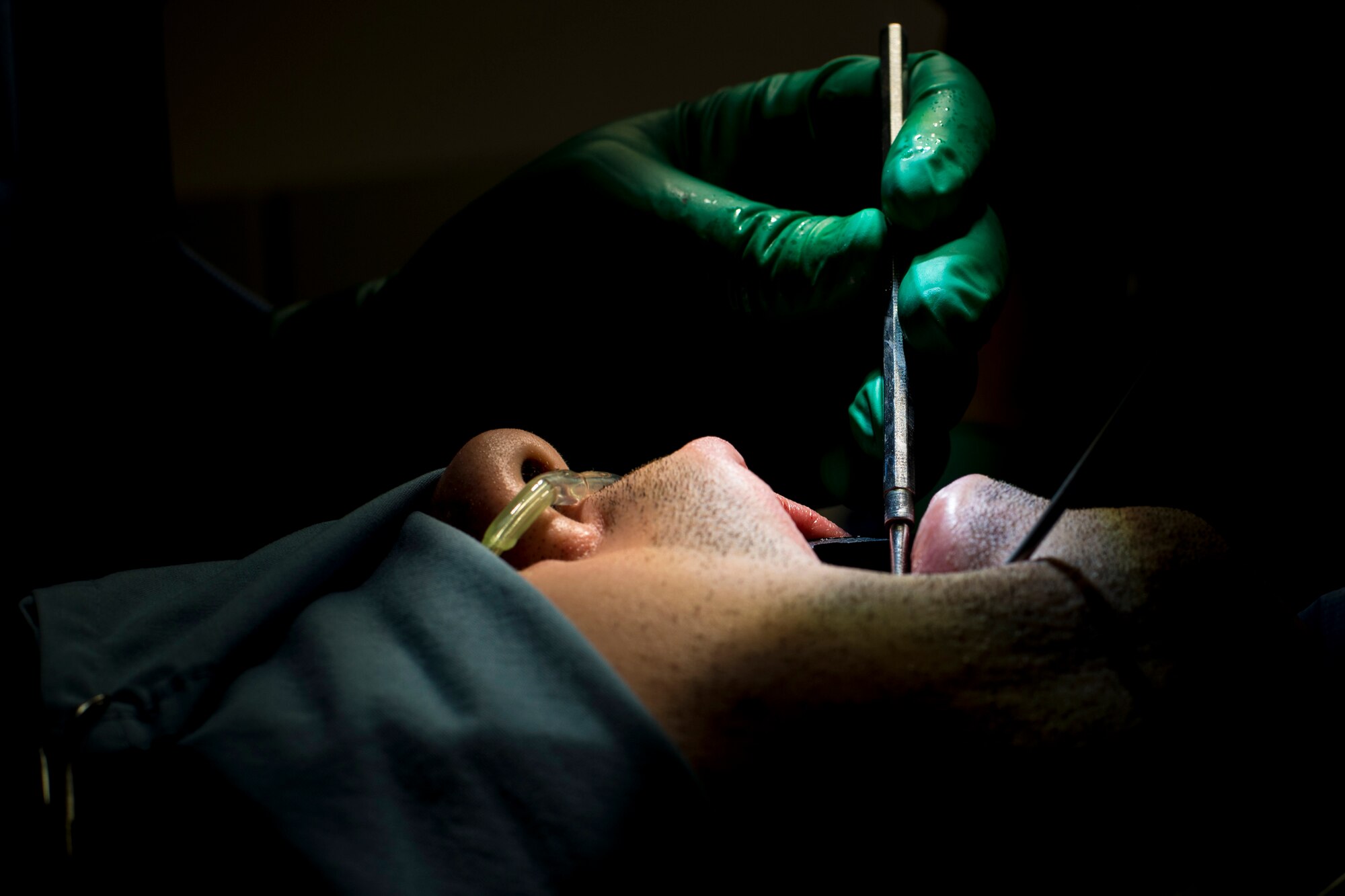 U.S. Air Force Capt. Jeremy Matis, 354th Dental Services Flight general dentist, performs oral surgery at Eielson Air Force Base, Alaska, Feb. 19, 2015. Wisdom teeth are located at the back of the mouth. They are difficult to reach to properly clean which can lead to infection and the need to remove them. (U.S. Air Force photo by Staff Sgt. Joshua Turner/Released)