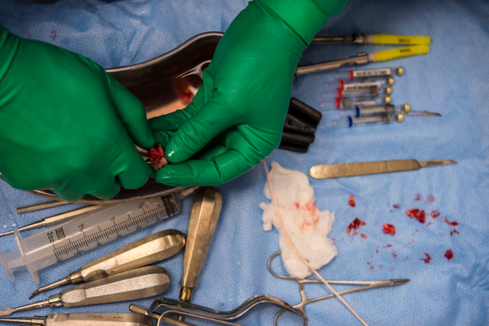 U.S. Air Force Capt. Jeremy Matis, 354th Dental Services Flight general dentist, cleans bone off of a wisdom tooth after an oral surgery on Eielson Air Force Base, Alaska, Feb. 19, 2015. Wisdom teeth are located at the back of the mouth. They are difficult to reach to properly clean which can lead to infection and the need to remove them. (U.S. Air Force photo by Staff Sgt. Joshua Turner/Released)
