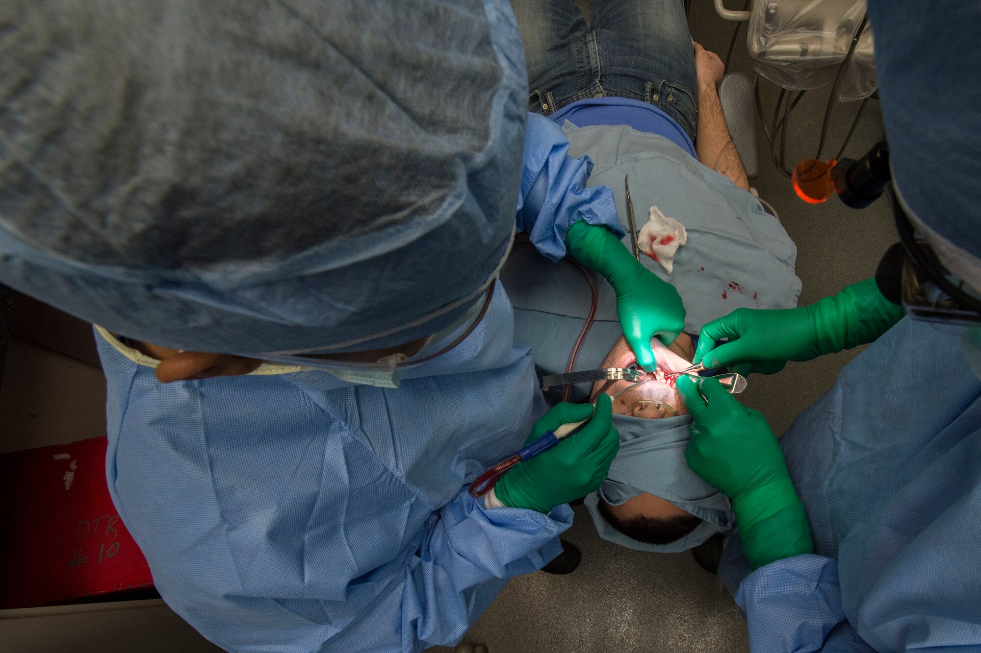 U.S. Air Force Senior Airman Jerome Javier, 354th Dental Services Flight dental technician, assists Capt. Jeremy Matis, 354th Dental Services Flight general dentist, during a surgery to remove wisdom teeth on Eielson Air Force Base, Alaska, Feb. 19, 2015 Wisdom teeth are located at the back of the mouth. They are difficult to reach to properly clean which can lead to infection and the need to remove them. (U.S. Air Force photo by Staff Sgt. Joshua Turner/Released)