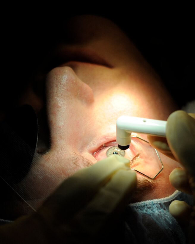 Col. (Dr.) Joseph Giovannini, 779th Aerospace Medical Squadron ophthalmologist, uses a rotary scrubber to remove epithelium cells prior to a Photorefractive Keratectomy procedure March 18, 2015, in Malcolm Grow Medical Clinics and Surgery Center on Joint Base Andrews, MD. After scrubbing, a laser can reshape the eye as needed for the patient’s prescription. (U.S. Air Force photo/Senior Airman Preston Webb)