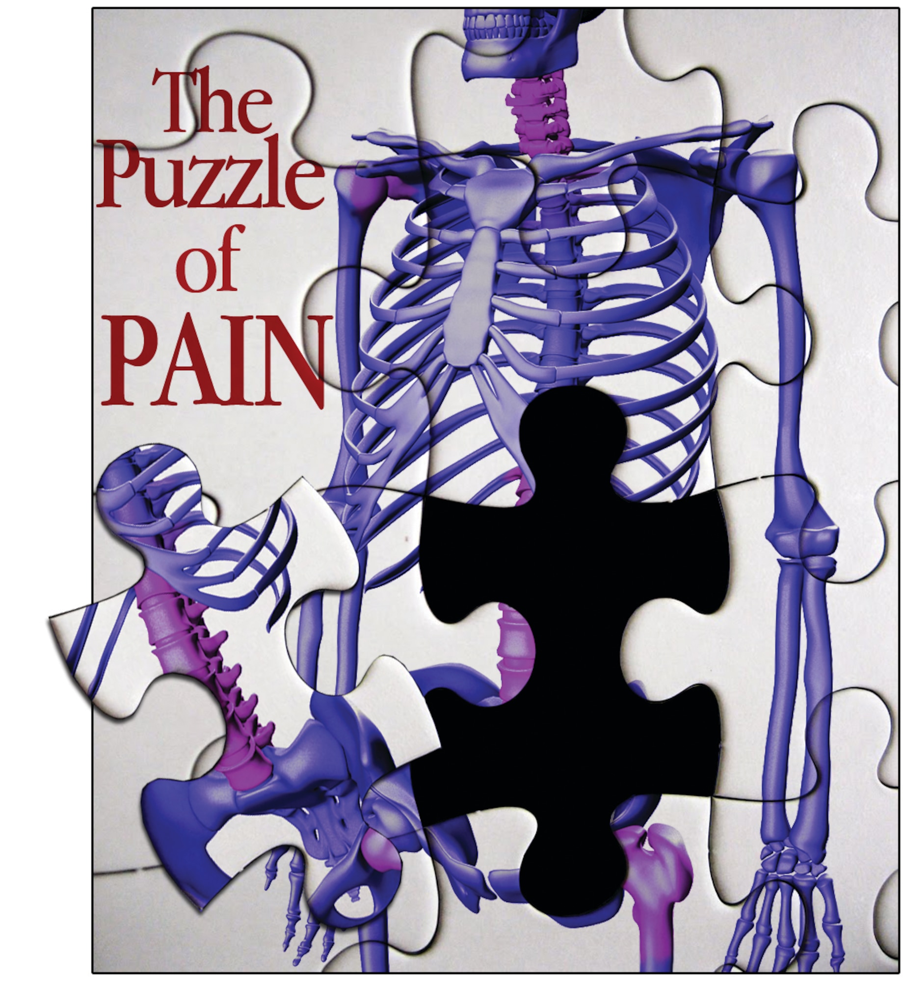 The cause of chronic pain is not always apparent. Airmen at the 673d Medical Group Pain Management Clinic strive to determine the cause of chronic pain in active duty members and their dependents with minimal use of narcotics. (U.S. Air Force Photo Illustration/Chris McCann)