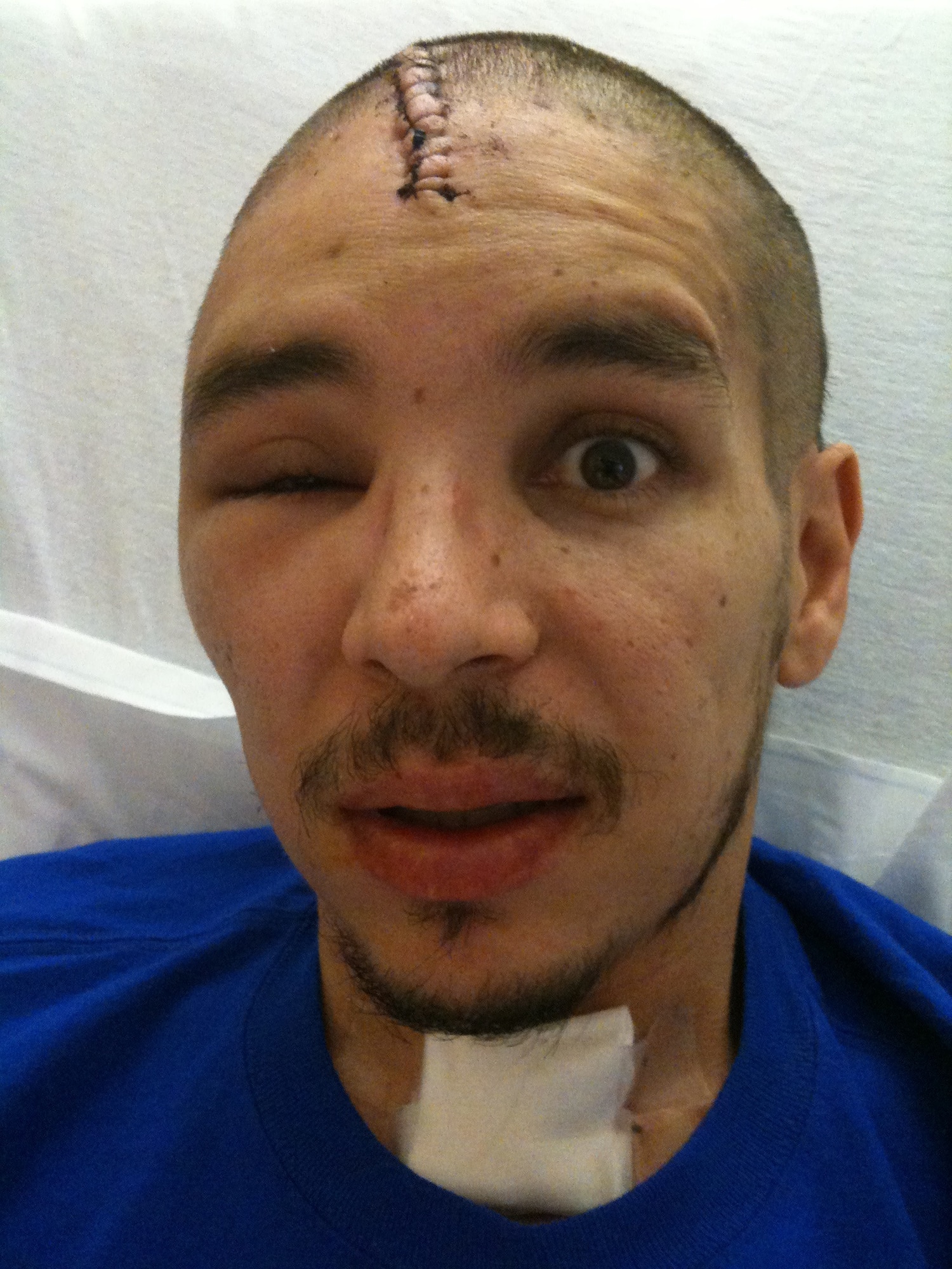 Then Master Sgt. Phillip Sisneros poses for a photo after waking up from a 30-day coma following a motorcycle accident in Las Vegas on Aug. 13, 2011. His wife, Master Sgt. Angela Sisneros, keeps this photo of Phillip on her desk at work in the 99th Communications Squadron, where she is the NCO in charge of plans and projects, to remind her that everything’s going to be alright. (Photo courtesy of retired Master Sgt. Phillip Sisneros)