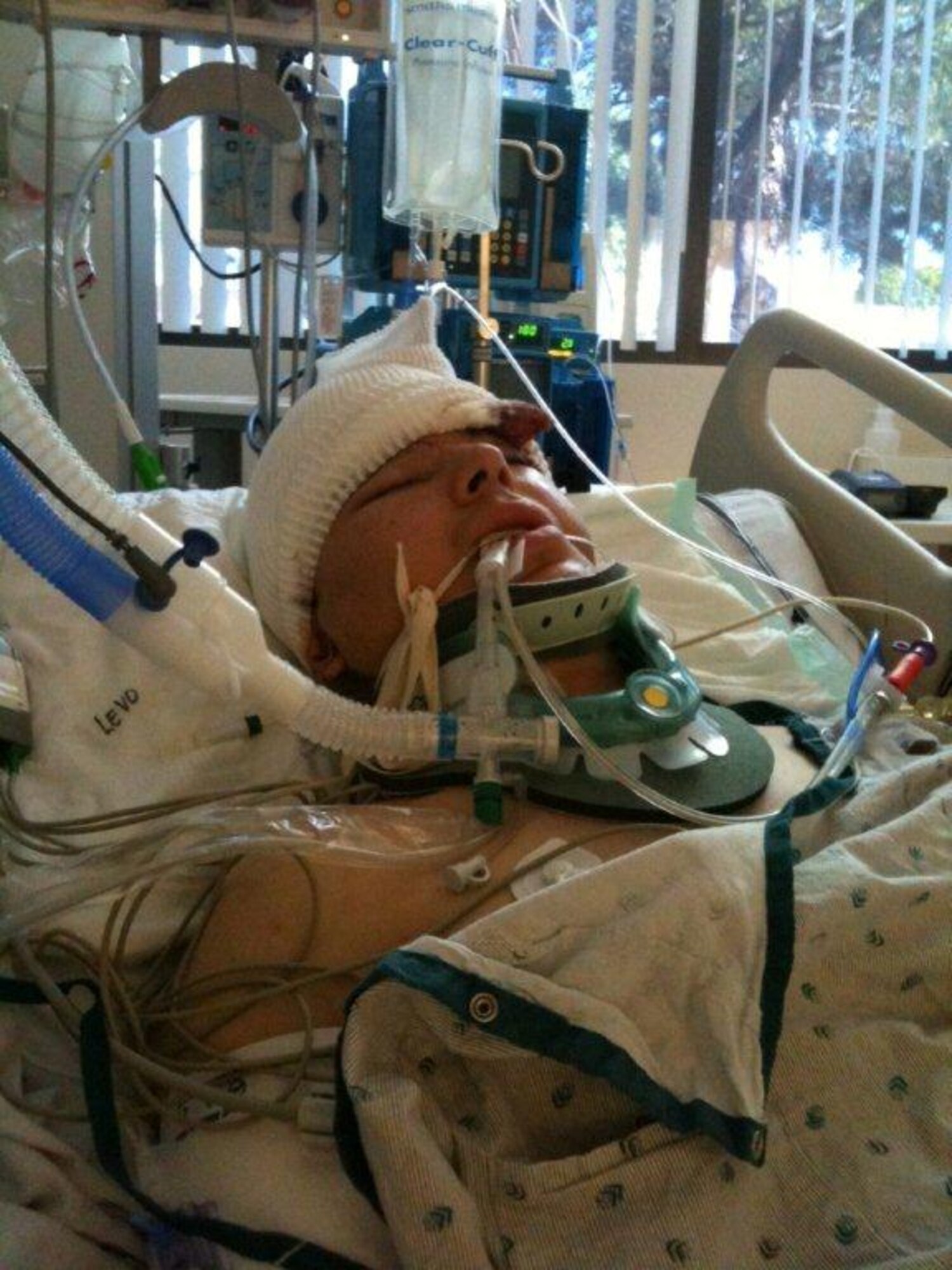 Then Master Sgt. Phillip Sisneros, 99th Communications Squadron comm focal point chief, lays in a coma following a motorcycle accident in Las Vegas on Aug. 13, 2011. Sisneros awoke from his coma 30 days after the accident, but suffered a traumatic brain injury that would eventually lead to his medical retirement in 2014. (Photo courtesy of retired Master Sgt. Phillip Sisneros)