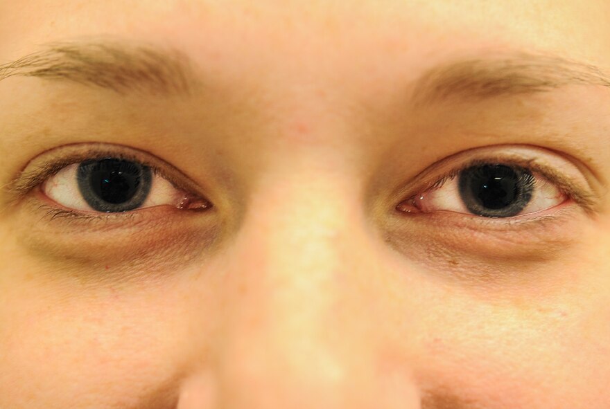 Chelsea Hanson poses for a photograph after her eyes have been dilated in the optometry clinic on Minot Air Force Base, N.D., March 23, 2015. Eye drops are used to dilate her pupils so that the optometrist can have a better view of the inside of the eye during her examination. (U.S. Air Force photo/Senior Airman Stephanie Morris)