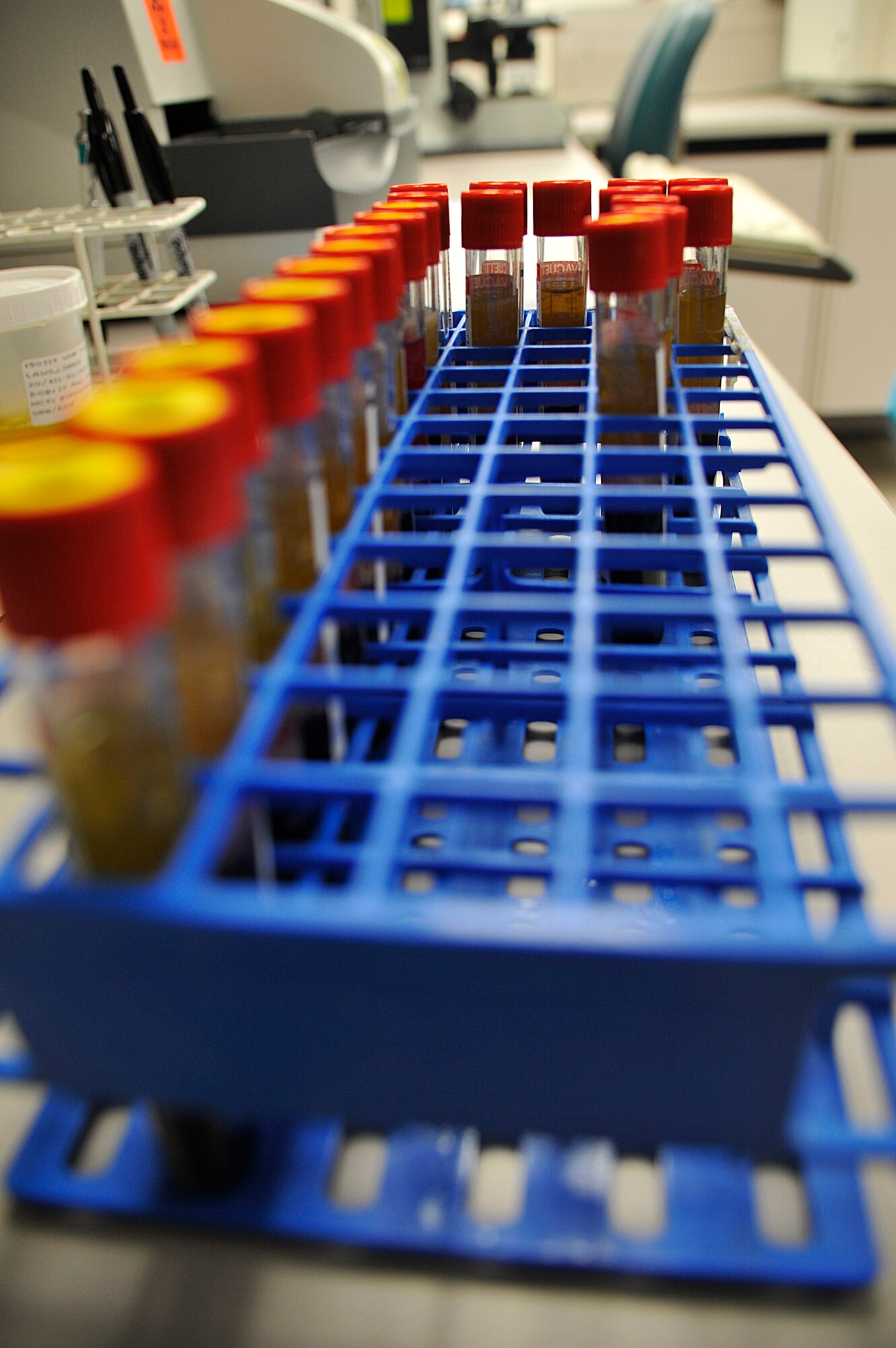 Blood samples await shipment at Whiteman Air Force Base, Mo., March 18, 2015. Once samples are examined, they are processed and shipped to reference laboratories for advanced testing. (U.S. Air Force photo by Senior Airman Keenan Berry/Released)