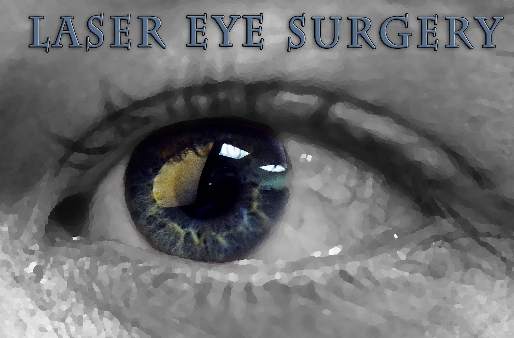 Laser eye surgery is becoming an increasingly popular treatment method for Airmen. Refractive surgeries, better known as LASIK and PRK are fully covered for Airmen meeting procedure requirements. (U.S. Air Force photo illustration/Airman 1st Class Collin Schmidt)