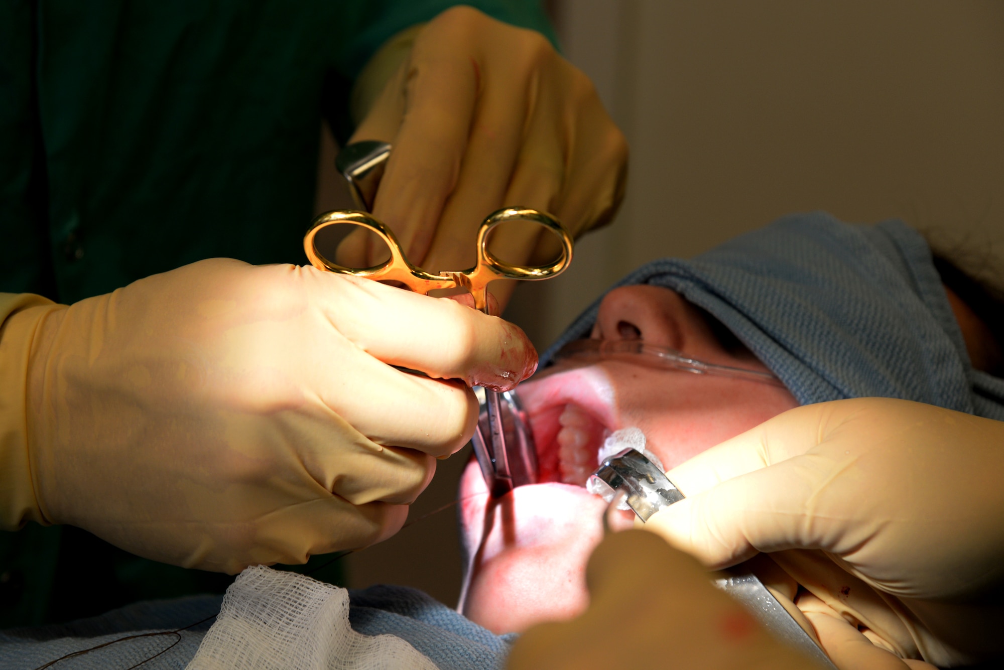 Capt. Kyle Christensen and Lisa Whisenhunt perform a wisdom teeth extraction April 8, 2015, at the Scott Clinic, Scott Air Force Base, Illinois. Wisdom teeth are extracted to correct or prevent future problems that may occur. Christensen is a General Dentist and Whisenhunt is a Dental Technician from the 375th Dental Squadron. (U.S. Air Force Photo by Airman 1st Class Megan Friedl)
