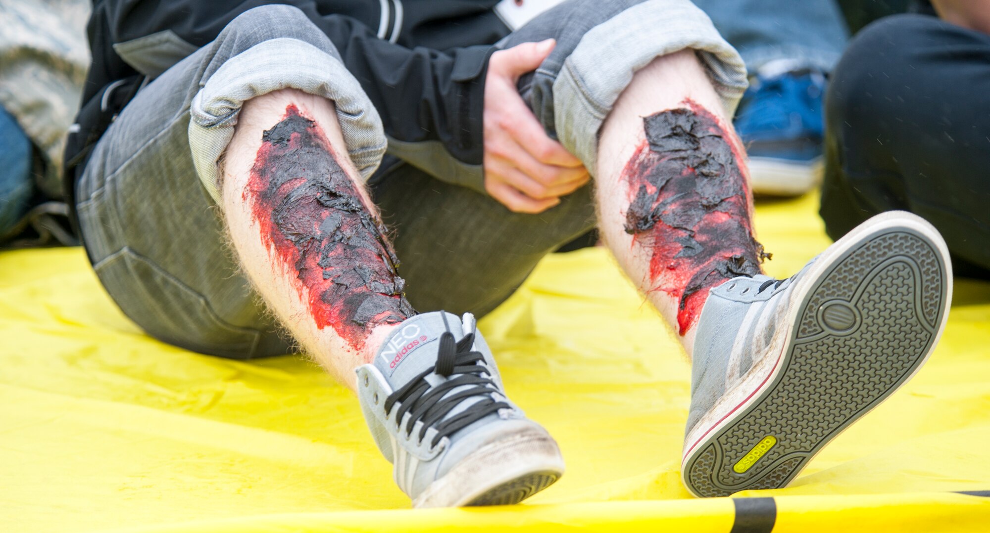 A simulated aircraft accident patient with burn injuries waits to be treated during a major accident response exercise May 20, 2015, at Whiteman Air Force Base, Mo. During emergencies, first responders must be ready to treat a wide variety of injuries, from burns to sucking chest wounds. (U.S. Air Force photo by Staff Sgt. Brigitte N. Brantley/Released)