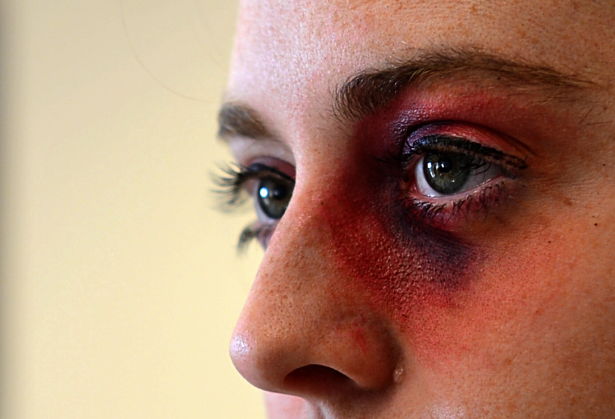 1st Lt. Harriet Randolph, 48th Contracting Squadron contract specialist, wears moulage makeup simulating a black eye at Royal Air Force Lakenheath, England, Oct. 14, 2015. As October is Domestic Violence Awareness month, the Black-Eye Campaign was planned to engage and educate Airmen on the issue and how to report it. (U.S. Air Force photo by Senior Airman Erin O’Shea/Released)