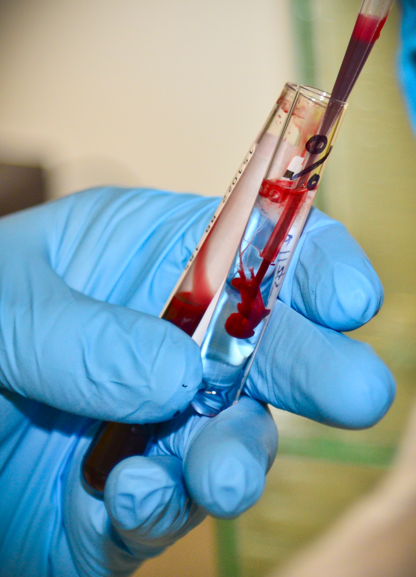Blood is placed in a solution to determine a patient's blood type in the laboratory at Osan Air Base, Republic of Korea, Oct. 22, 2015. Once a lab technician determines the blood type on a patient who hasn’t had a blood typing before, he must have another lab tech confirm the findings separately to ensure 100 percent accuracy. (U.S. Air Force photo/Tech. Sgt. Travis Edwards)