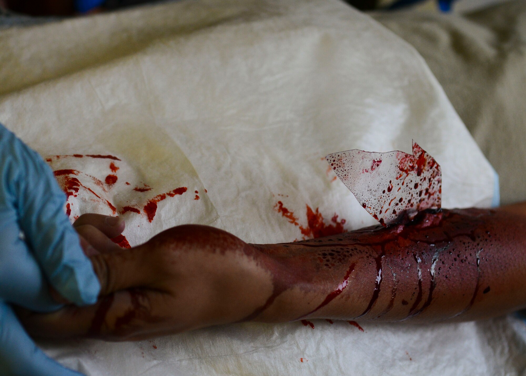 A U.S. Air Force Airman acts as a patient during the Expeditionary Medical Support training for exercise Immediate Response 15. Exercise IR 15 is designed to enhance regional stability, strengthen partnership capacities and improve interoperability between partner nations. (U.S. Air Force photo by Senior Airman Austin Harvill/Released)