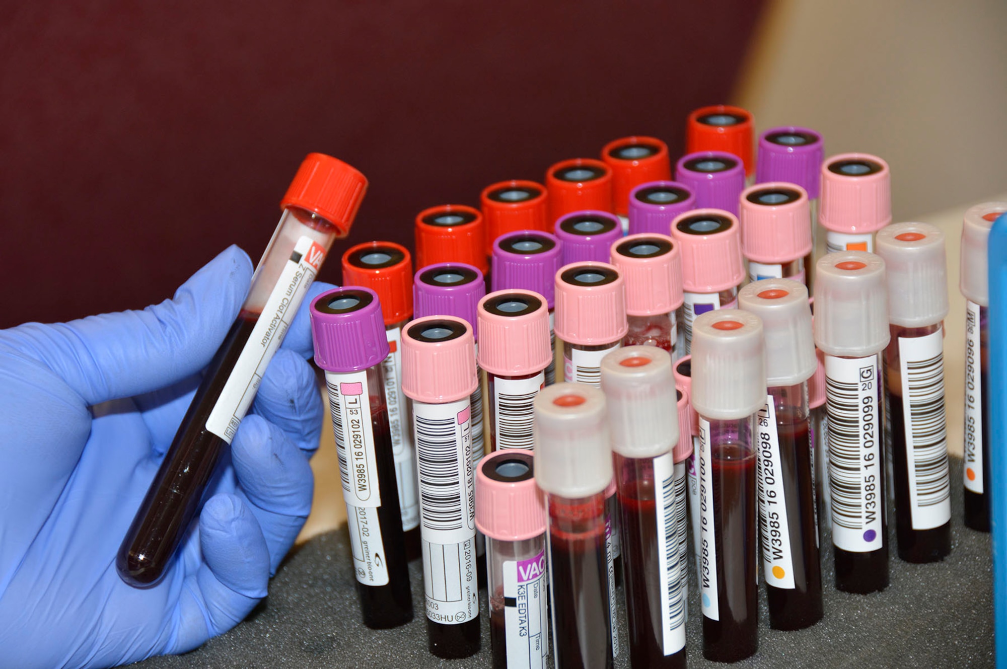 Vials of blood donated by Airmen from the 145th Airlift Wing wait to be tested by Community Blood Center of the Carolinas. Over a dozen tests are performed on each vial including establishing blood types. The blood collected during the blood drive held on April 9, 2016 at the North Carolina Air National Guard Base, Charlotte Douglas International Airport, helps patients within the local community. Donating one pint takes an hour or less, and in the end one walks away having saved up to three lives. (U.S. Air National Guard photo by Master Sgt. Patricia F. Moran/Released)
