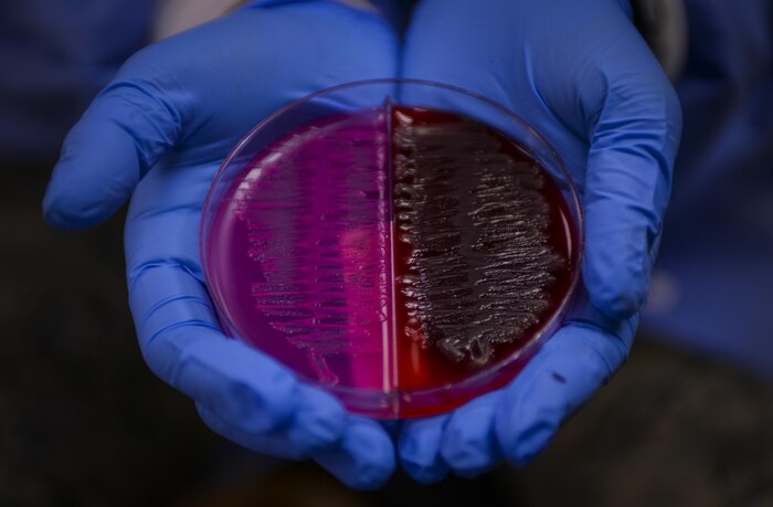 Senior Airman Vianey Wainright, 99th Medical Support Squadron medical laboratory technician, holds a agar plate at the laboratory in the Mike O’Callaghan Federal Medical Center at Nellis Air Force Base, Nev., on April 15, 2016. An agar plate is a Petri dish that contains a growth medium  used to culture microorganisms. (U.S. Air Force photo by Airman 1st Class Nathan Byrnes)