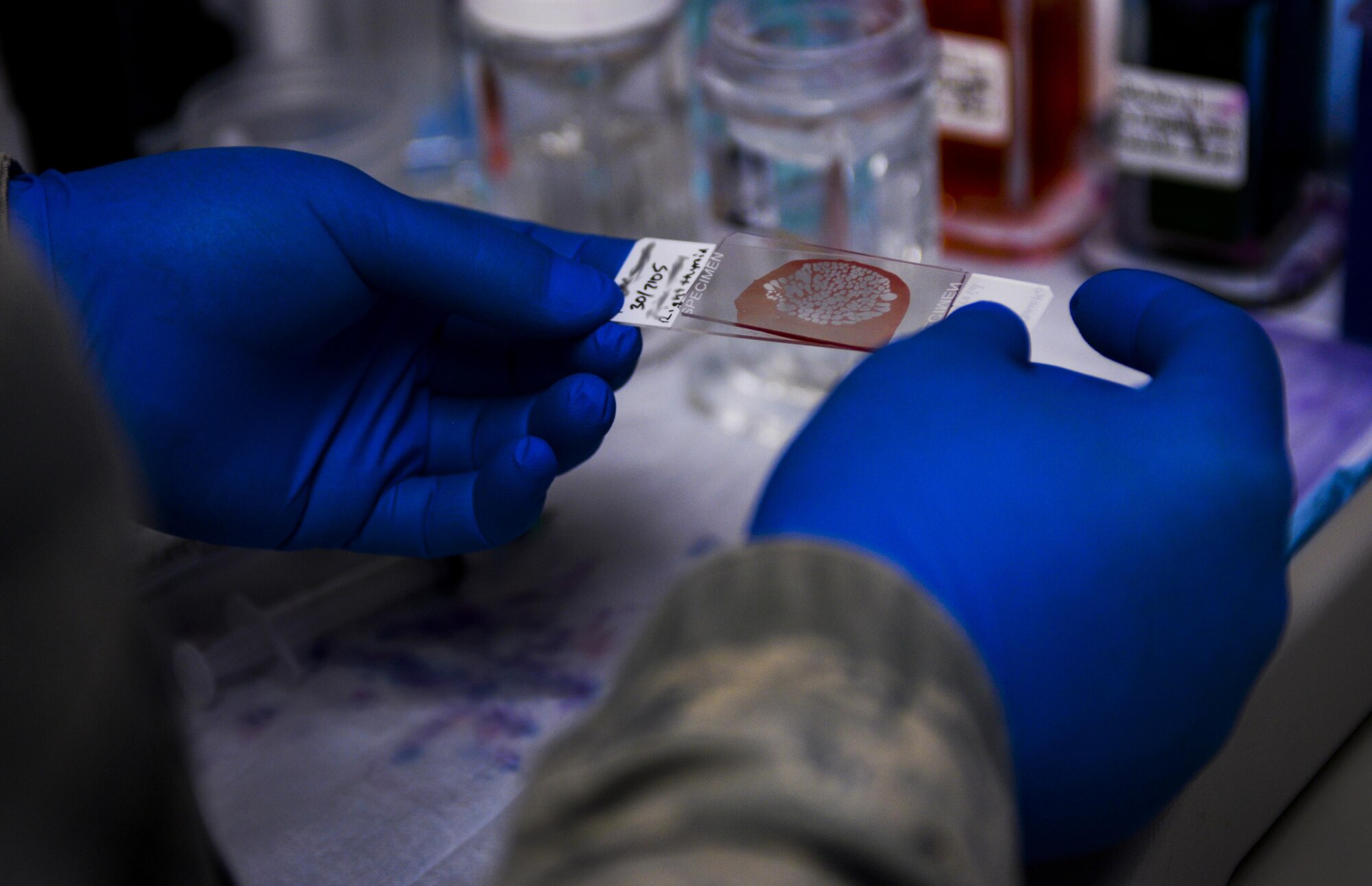 Maj. (Dr.) Joe Restivo, D.O., 99th Medical Support Squadron pathologist, prepares a slide during a fine needle aspiration biopsy at the Mike O’Callaghan Federal Medical Center at Nellis Air Force Base, Nev., on April 15, 2016. A pathologist is a physician who studies body fluids and tissues, helps the primary care doctor make a diagnosis about ones health or any medical problems one have, and uses laboratory tests to monitor the health of patients with chronic conditions. (U.S. Air Force photo by Airman 1st Class Nathan Byrnes)