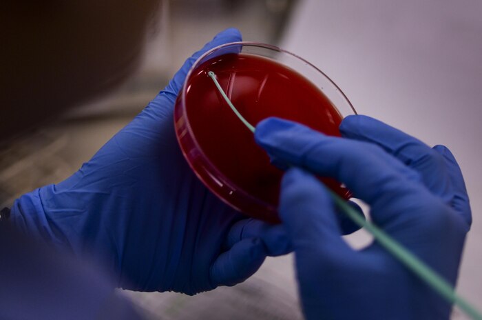 Senior Airman Vianey Wainright, 99th Medical Support Squadron laboratory technician, holds an agar plate at Nellis Air Force Base, Nev., April 15, 2016. The 99th Medical Support Squadron ensures maximum wartime readiness in support of the largest and most diverse bases in Air Combat Command. (U.S. Air Force photo by Airman 1st Class Kevin Tanenbaum)