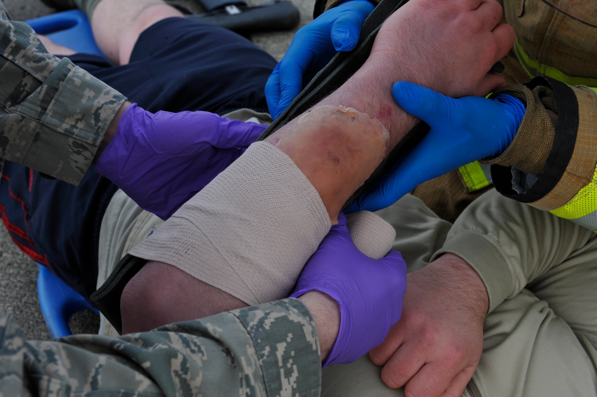 First responders wrap and splint a simulated casualties arm during the Wing Thunder inspection April 26, 2016 at Ramstein Air Base, Germany. Wing Thunder was an inspection to evaluate the operational readiness and response of Team Ramstein. (U.S. Air Force photo/Staff Sgt. Leslie Keopka)