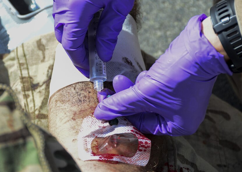 A member from the 379th Expeditionary Medical Operations Squadron inserts an IV site into a patient during a Major Accident Recovery Exercise April 26, 2016, at Al Udeid Air Base, Qatar.  The 379th Air Expeditionary Wing and host nation worked together to respond to a simulated crisis. There were approximately 95 wing and 22 host nation participants ranging from security forces, command and control, fire department, and medical personnel. (U.S. Air Force photo/Senior Airman Janelle Patiño/Released)