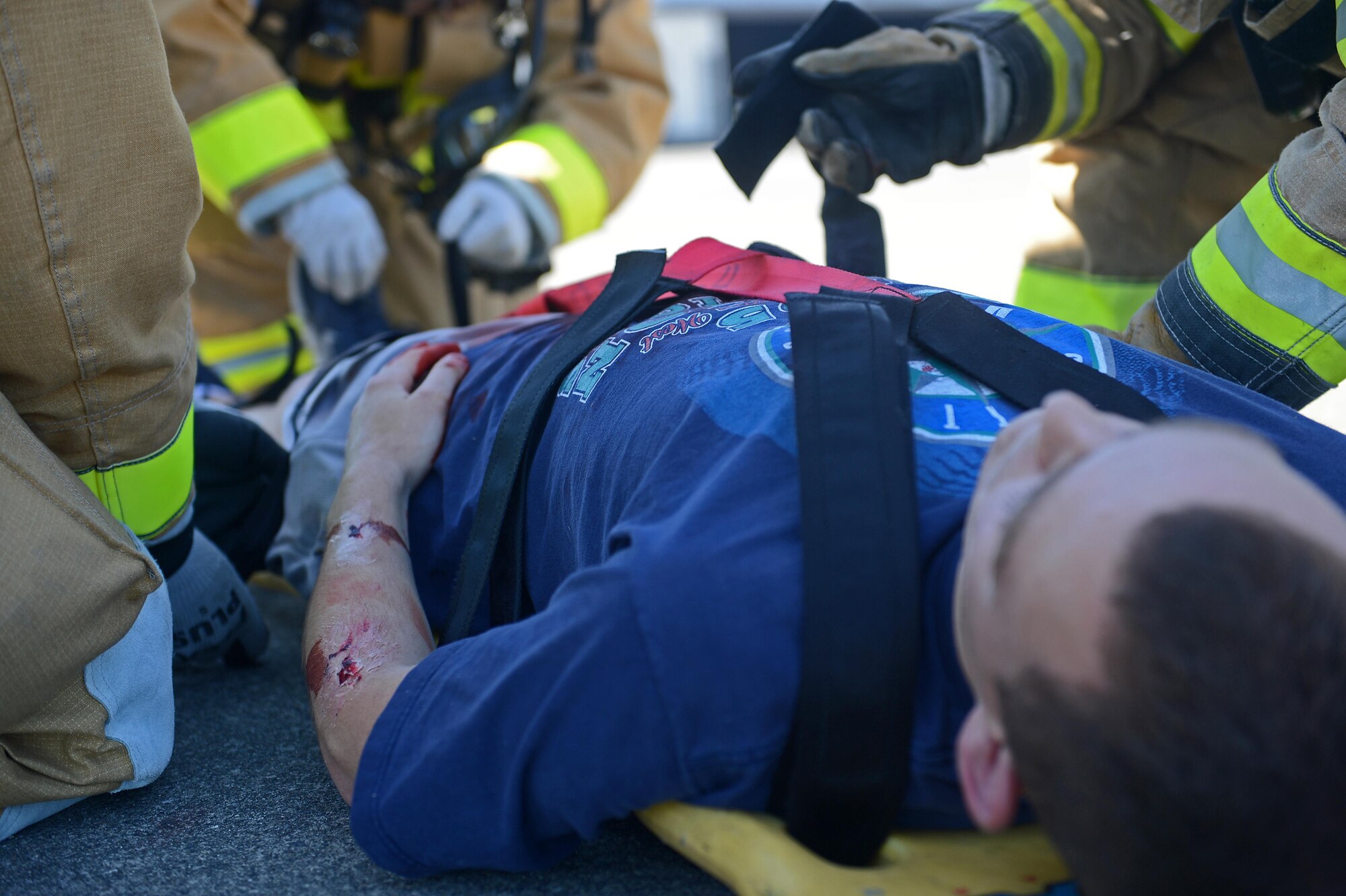 A simulated mass casualty victim is treated for injuries during Cascade Helix, July 27, 2016 on McChord Field, Wash. The mass-casualty exercise was designed to simulate an aircraft crash during an air show. It was a chance for first-responders to test their skills before the air show in August. (U.S. Air Force photo/Senior Airman Divine Cox)
