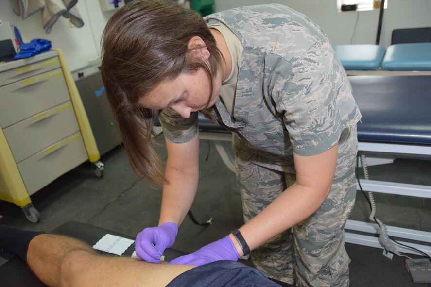Maj. Erin R. Sturgell, 379th Expeditionary Medical Operations Squadron physical therapist, uses dry needling on the quadriceps of U.S. Army Sgt. Karl Hawthorne, Combined Air Operations Center air defense communications and tactics specialist, July 28, 2016, at Al Udeid Air Base, Qatar. Dry needling treats muscular dysfunction and is a healing technique used to relieve pain and helps muscle fibers to reset and restore their function. (U.S. Air Force photo/Technical Sgt. Carlos J. Treviño/Release)