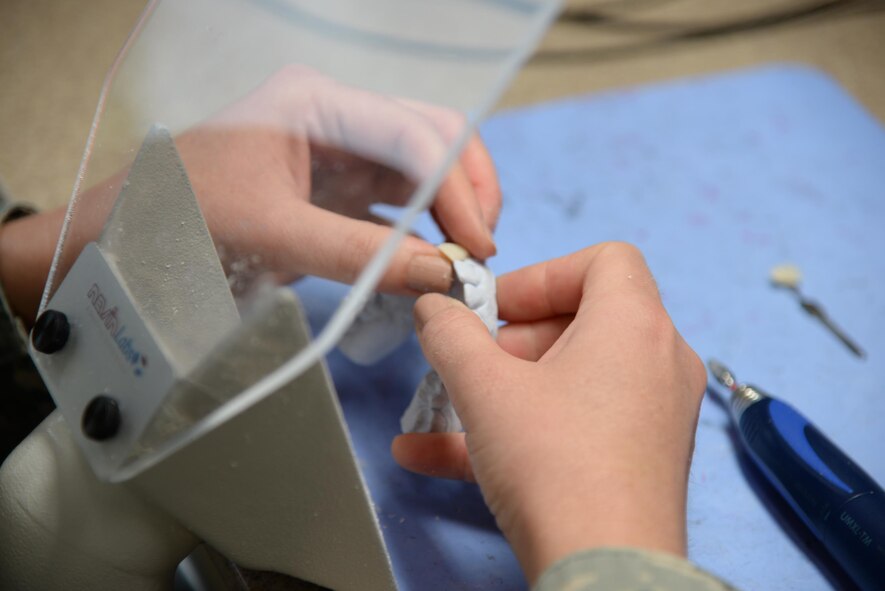 Staff Sgt. Maria Schinella, 14th Medical Operations Squadron Dental Technician, fits an implant to a mold of a patient’s mouth July 26 at Columbus Air Force Base, Mississippi. Dental techs create implants and work with the metal used in fillings and crowns. (U.S. Air Force photo/Airman 1st Class John Day)