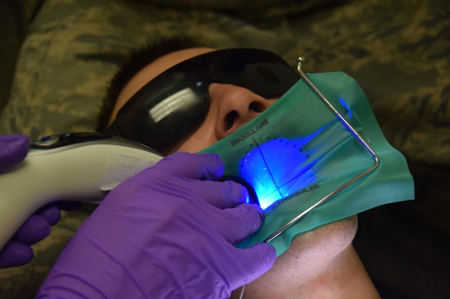 Staff Sgt. Shane Hinton, 379th Expeditionary Medical Operations Squadron dental technician, uses a curing light to solidify liquid dental materials inside a root canal on Senior Airman Jordan Thompson, 379th Expeditionary Logistics Readiness Squadron fuels and cryogenics operator, July 30, 2016, at Al Udeid Air Base, Qatar. Dental technicians like Hinton perform dental cleanings, prepare dental instruments, and assist dentists with procedures like extractions and root canals. (U.S. Air Force photo/Technical Sgt. Carlos J. Treviño/Released)