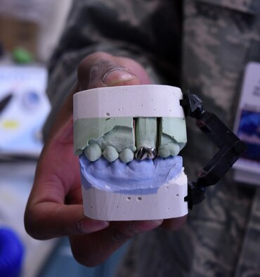 Staff Sgt. Khodie Morgan, 341st Medical Operations Squadron dental laboratory technician, holds a completed gold crown in the dental laboratory Dec. 5, 2016, at Malmstrom Air Force Base, Mont. A gold crown is made if a patient’s natural tooth is decaying and can no longer be repaired by fillings. (U.S. Air Force photo/Senior Airman Jaeda Tookes)