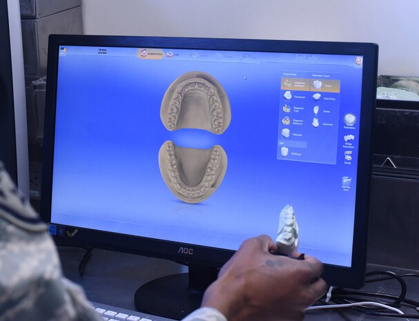 Staff Sgt. Khodie Morgan, 341st Medical Operations Squadron dental laboratory technician, creates a digital case file of a crown pattern using a computer-aided design and manufacturing machine in the dental laboratory Dec. 5, 2016, at Malmstrom Air Force Base, Mont. Creating a case file is the beginning process to create a crown. (U.S. Air Force photo/Senior Airman Jaeda Tookes)