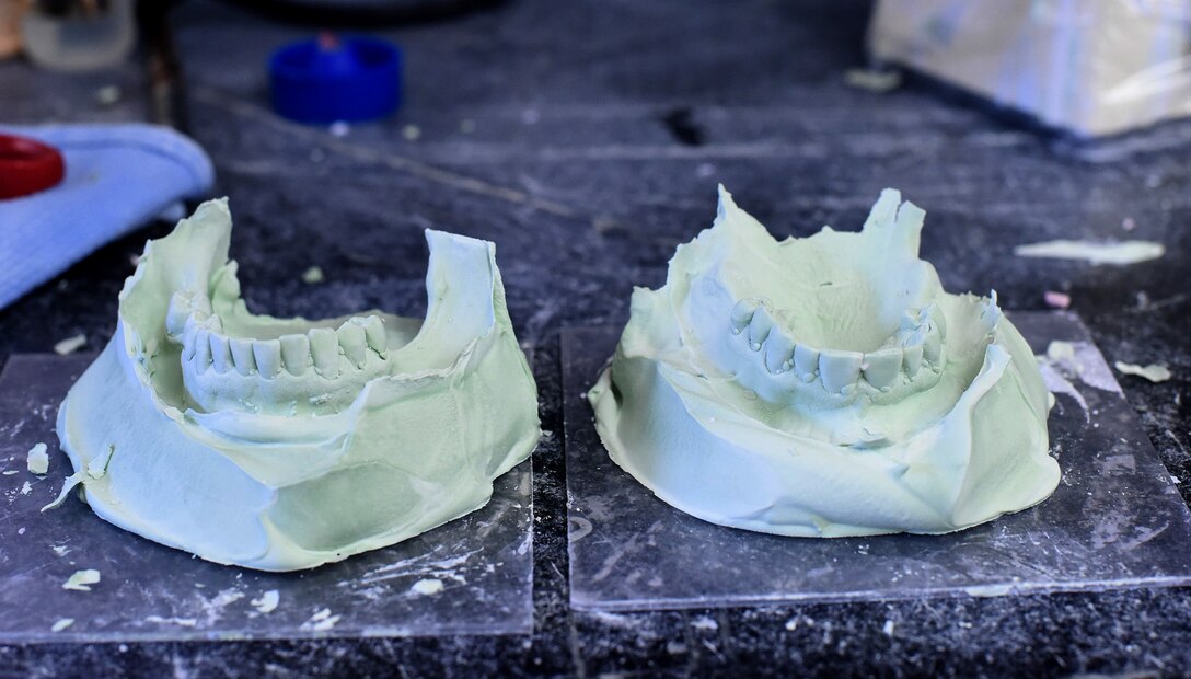 Upper and lower stone dental casts dry in the dental laboratory Dec. 5, 2016, at Malmstrom Air Force Base, Mont. The dental casts are representations of a patient’s mouth to replicate a specific tooth. (U.S. Air Force photo/Senior Airman Jaeda Tookes)

