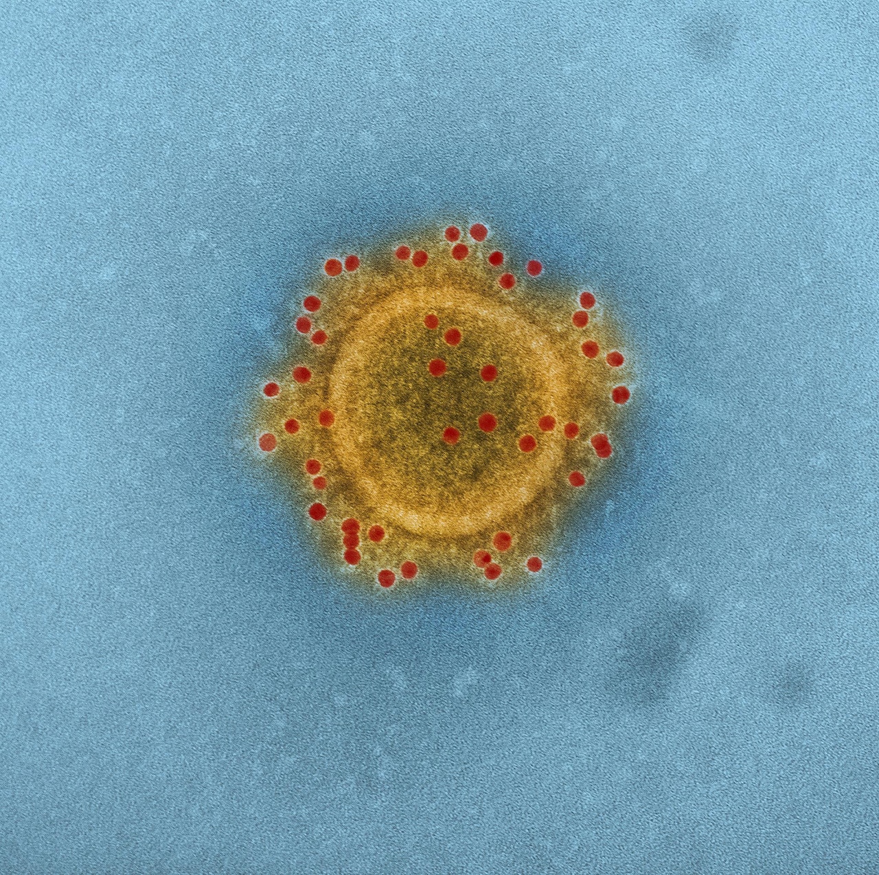 This image shows Middle East respiratory syndrome coronavirus particle envelope proteins immunolabeled with rabbit HCoV-EMC/2012 primary antibody and goat anti-rabbit 10-nanometer gold particles. National Institute of Allergy and Infectious Disease photo