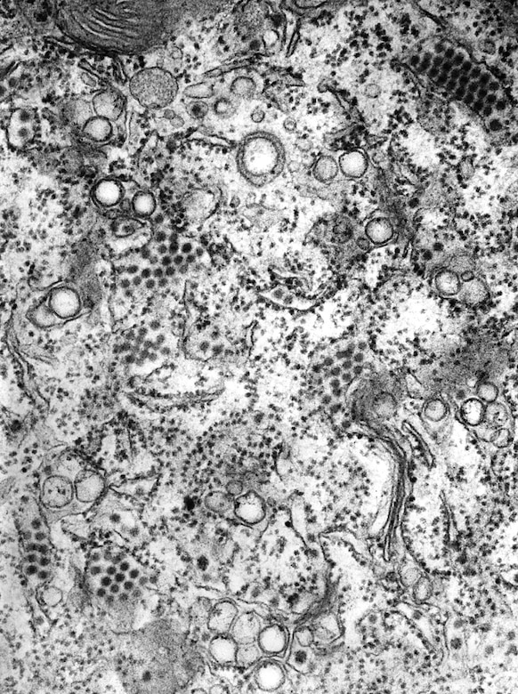 This transmission electron micrograph showed many St. Louis encephalitis virus particles contained inside a central
nervous system tissue sample. St. Louis encephalitis virus is one of the diseases that will be detectable in a new
high-tech mosquito-catching device called a smart trap being developed for the Defense Threat Reduction Agency by Sandia National Laboratory. CDC photo by Dr. Fred Murphy and Sylvia Whitfield