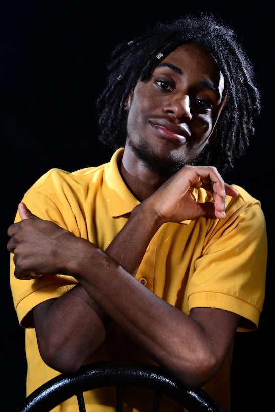 Kendall L. Mountain, a mess attendant at the Freedom Inn dining facility at Fort Meade, Md., shows scars on his arms. Mountain, who is also a student at Meade Senior High School, broke both arms and one leg during a 2012 car accident that killed his older brother.