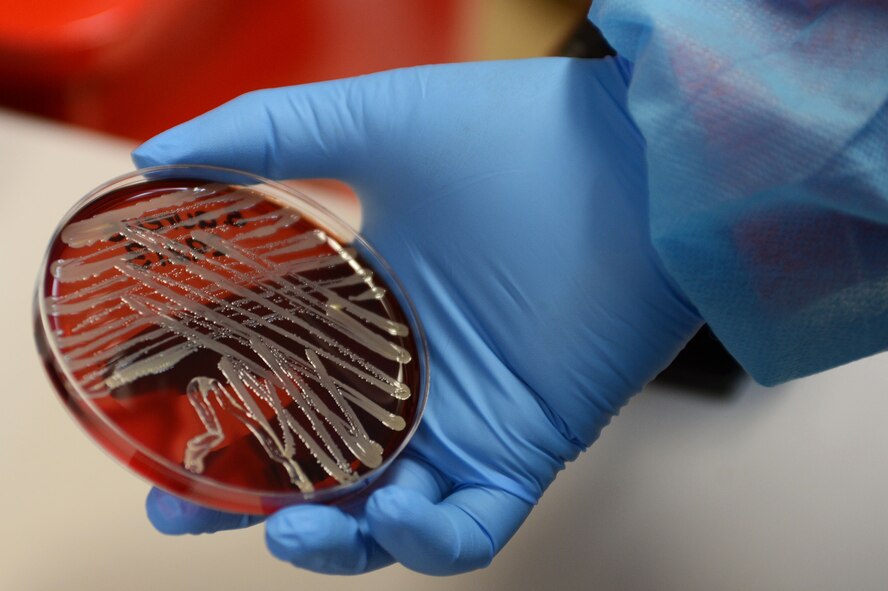 A medical lab technician assigned to the 20th Medical Support Squadron examines a tissue culture taken from a patient to identify the bacteria responsible for the patient’s illness at Shaw Air Force Base, S.C., Jan. 21, 2016. Medical lab technicians are responsible for collecting and preparing specimens for analysis as well as testing and analyzing specimens in order to aid in the diagnosis, treatment and prevention of disease. (U.S. Air Force photo by Senior Airman Zade Vadnais)