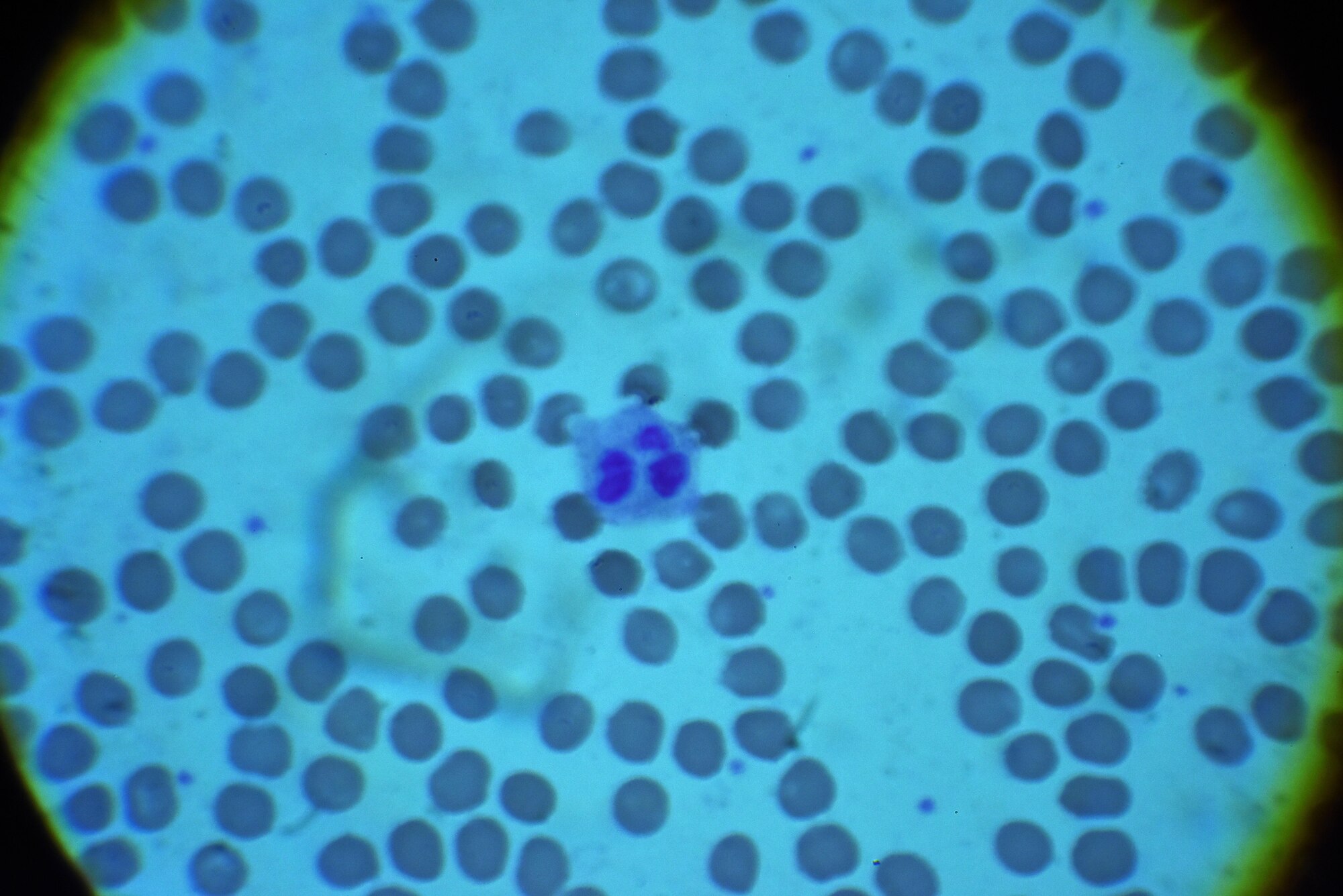 A white blood cell is viewed microscopically in a blood sample Jan. 21, 2016, at Seymour Johnson Air Force Base, North Carolina. Technicians at the 4th Medical Support Squadron's laboratory analyze blood samples from Seymour Johnson AFB personnel to check for viruses and other deficiencies in order to properly diagnose and treat patients at the 4th Medical Group clinic. (U.S. Air Force photo/Staff Sgt. Chuck Broadway)