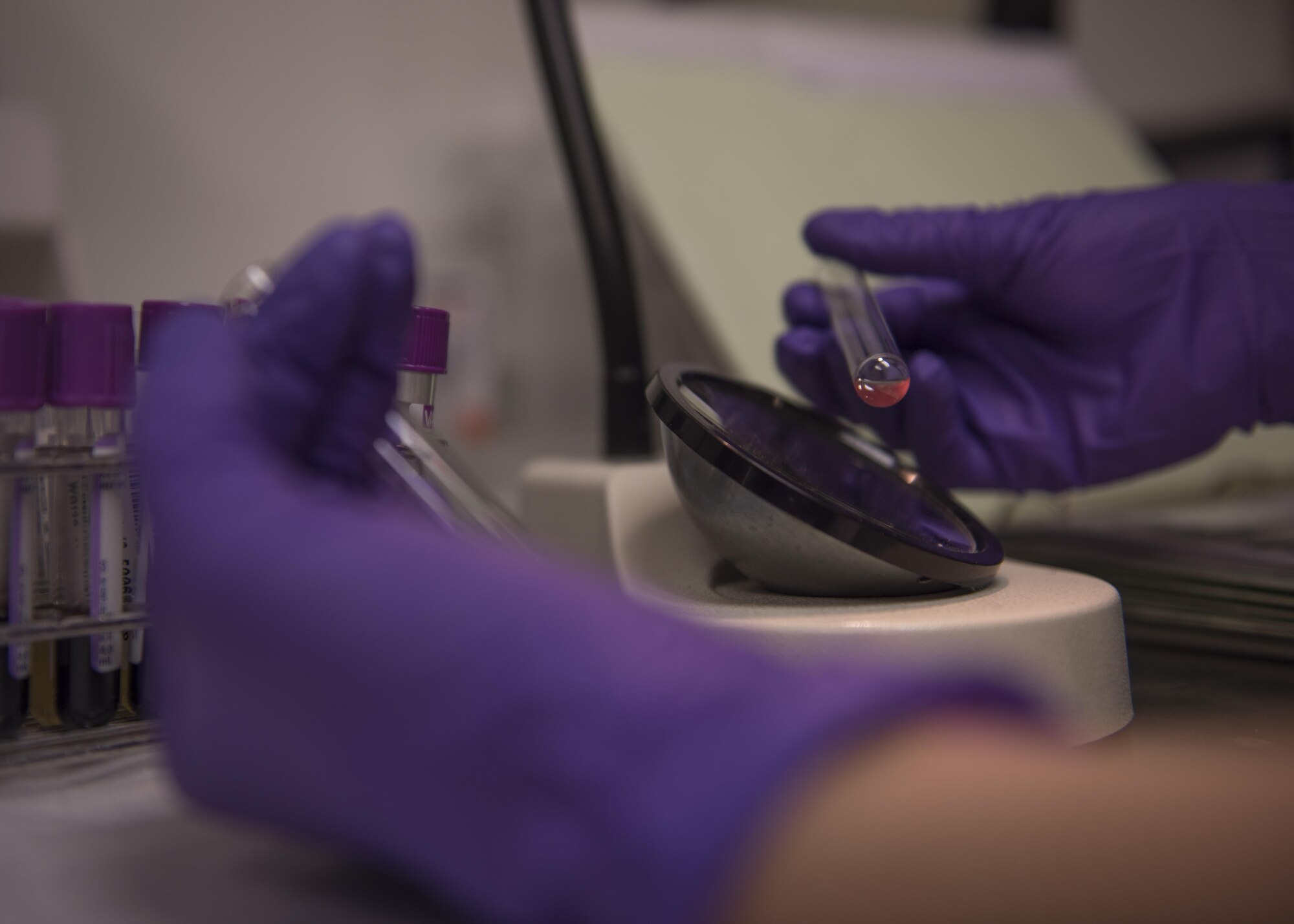 Staff Sgt. Megan Montagnino, 455th Expeditionary Medical Group non-commissioned officer in charge of microbiology and the blood bank, examines a blood sample, July 08, 2016, Bagram Airfield, Afghanistan. Montagnino mixed antibodies with a sample of a patient’s blood to verify the blood type. (U.S. Air Force photo by Senior Airman Justyn M. Freeman)
