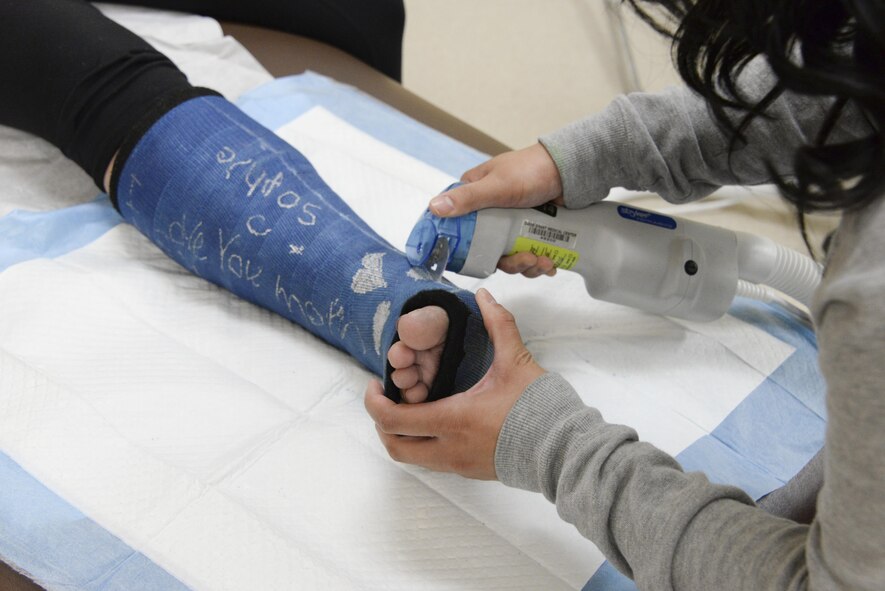 A cast is removed from a patients leg July 6 at David Grant USAF Medical Center. 