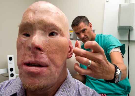 Maj. Stephen Cherrington, right, a 59th Dental Group maxillofacial prosthodontist, compares retired Army Master Sgt. Todd Nelson’s new prosthetic ear to his skin tone at the San Antonio Military Medical Center, Joint Base San Antonio-Fort Sam Houston, Texas, June 28, 2016. (U.S. Air Force photo/Staff Sgt. Kevin Iinuma)
