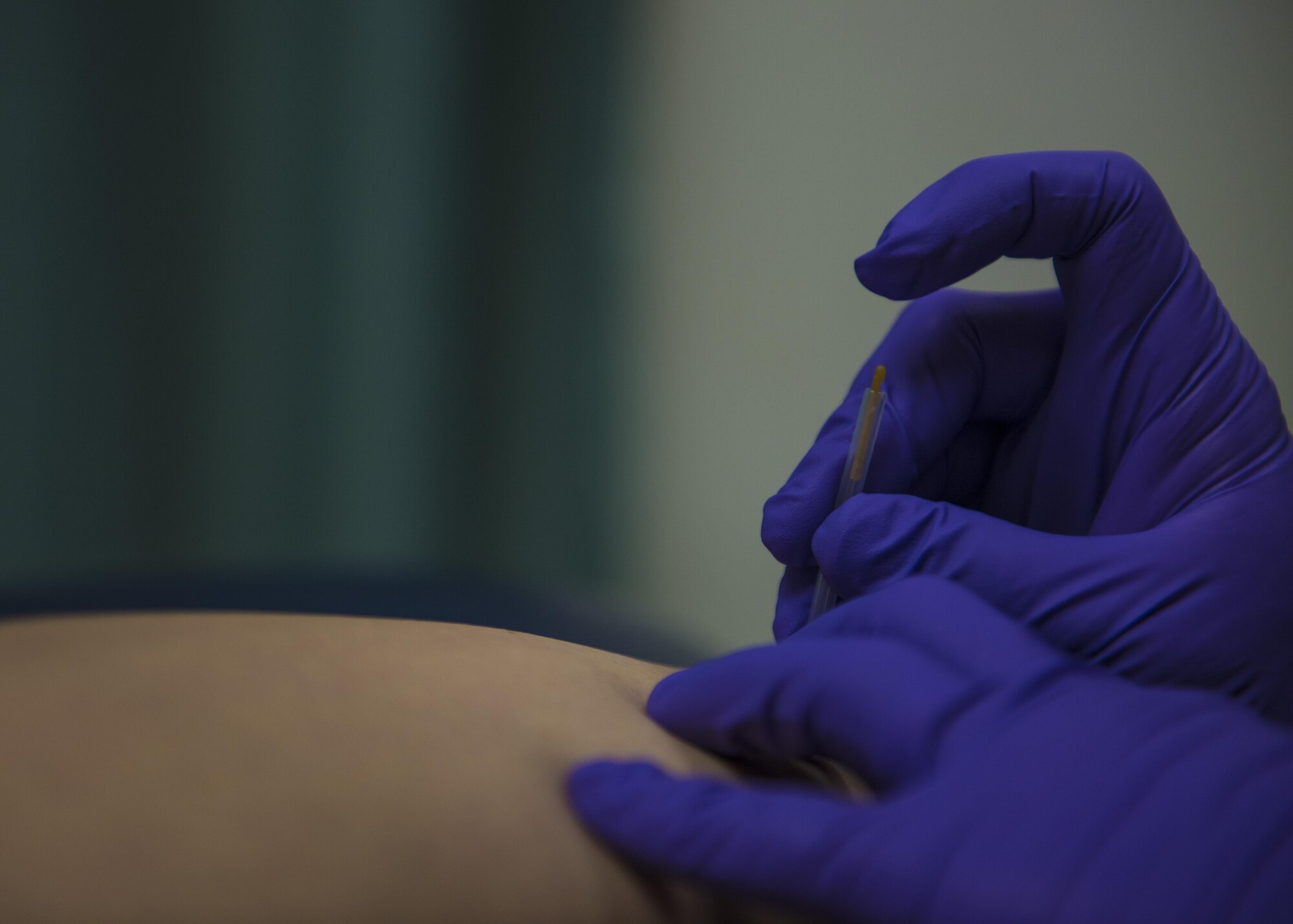 Maj. Brandon Morgan, 455th Expeditionary Medical Group physical therapist, conducts a dry needling procedure during a patient treatment, Bagram, Afghanistan, July 19, 2016. Dry needling stimulates the muscle and helps it relax so the muscle does not put more strain on the tendon. (U.S. Air Force photo by Senior Airman Justyn M. Freeman)