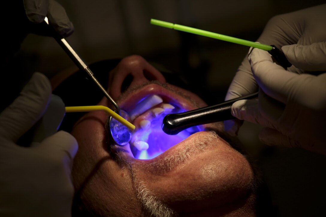 U.S. Air Force Maj. Jessica Bramlette, left, a dentist assigned to the New Jersey Air National Guard's 177th Medical Group, and Spc. Zhuhying Deng, a dental assistant from the U.S. Army Reserve's 7234th Medical Support Unit use a laser to form a filling on a patient at Homer Intermediate School, Homer, N.Y., July 20, 2016. Service members provided no cost medical, dental, optometry, and veterinary care to local residents as part of the Healthy Cortland 2016 Innovative Readiness Training mission. (U.S. Air National Guard photo by Tech. Sgt. Matt Hecht/Released)