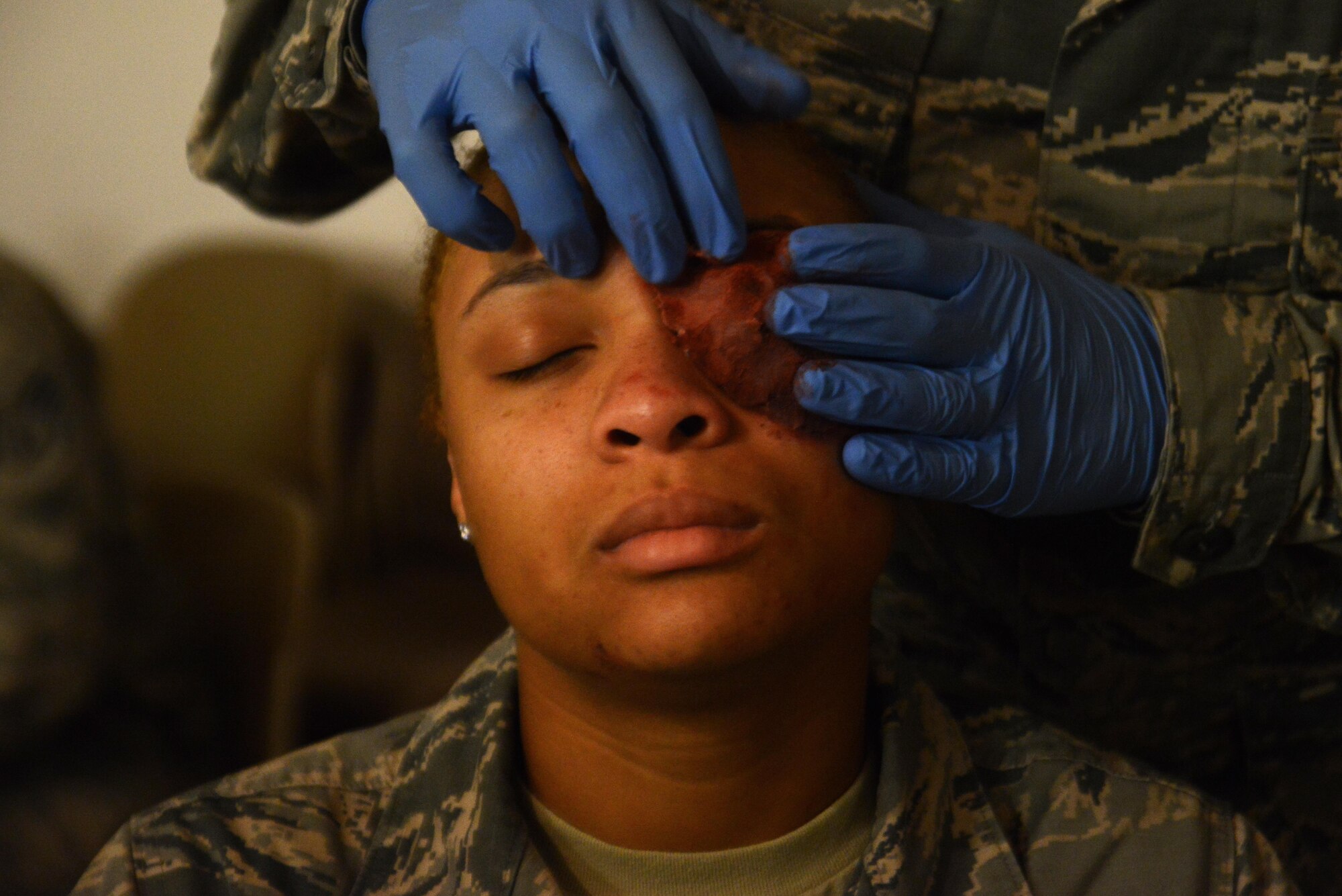 Airman 1st Class Bianka Best, 3rd Maintenance Group maintenance analyst, recieves a moulage of an eye injury during Mission Assurance Exercise 16-7 at Joint Base Elmendorf-Richardson, Alaska, July 15, 2016. JBER simulated an aircraft crash to test the base’s ability to operate, coordinate and recover in an efficient and timely manner. (U.S. Air Force photo by Airman 1st Class Christopher R. Morales)