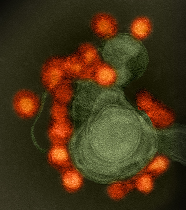 Transmission electron microscope image of negative-stained, Fortaleza-strain Zika virus, in red, isolated from a microcephaly case in Brazil. National Institutes of Health photo