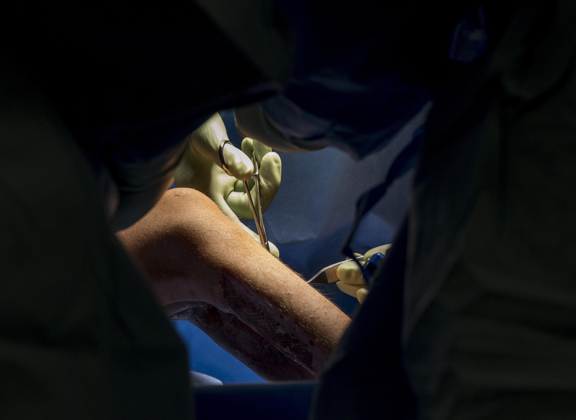 Surgeons work together to save the leg of an Afghan patient, June 10, 2016 at Craig-Joint Theater Hospital, Bagram Airfield, Afghanistan. Multiple surgeons from different specialties have come together in an effort to repair the patient’s leg after suffering a gun-shot wound that threatened to take her leg. (U.S. Air Force photo by Tech. Sgt. Tyrona Lawson)